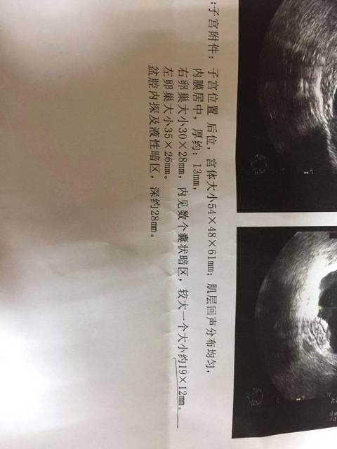 泉州可以的试管医院筛查结果高危一定就是唐氏儿吗