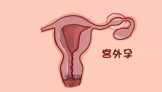 泉州九院可以试管找人代怀吗（泉州其他公立医院供卵试管有哪些？）